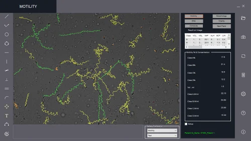 Offline CASA Software (Computer Assisted Semen Analysis) Model: SpermPro, For Windows, Free Demo/Trial Available