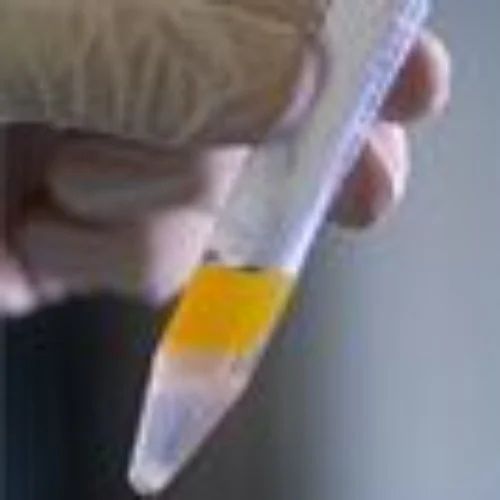 DETAILED SEMEN ANALYSIS