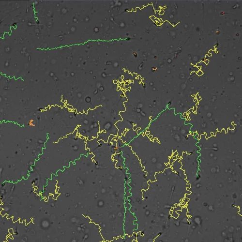 Computer Assisted Semen Analysis Software Sperm Lite