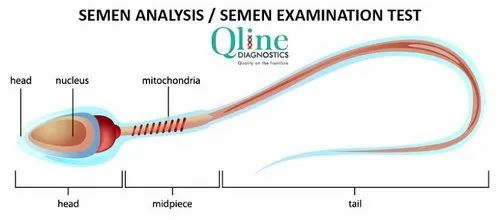 Semen Analysis
