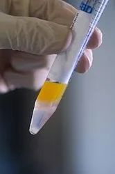 Semen Analysis