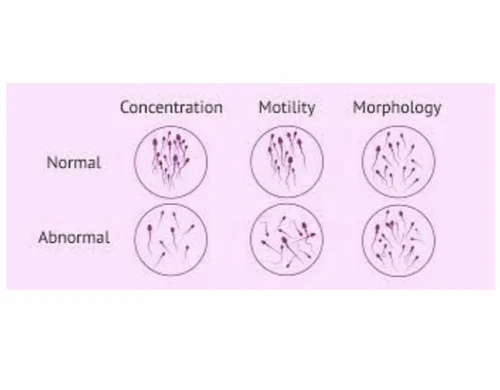 Semen Analysis Services