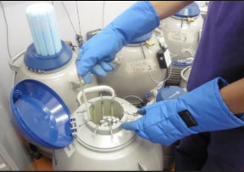 Semen Cryopreservation Treatment Service