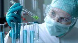 Semen Test
