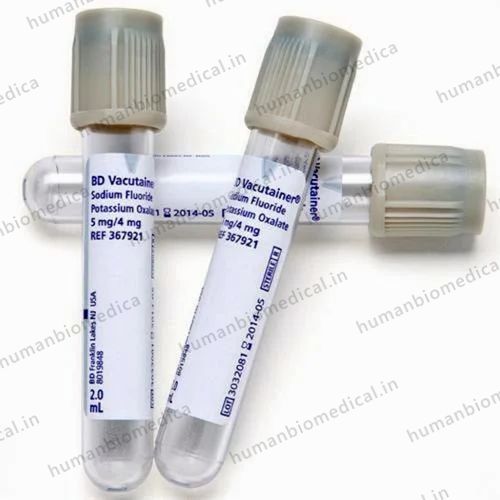 Plastic Sodium Glucose/Fluoride Vacutainer-2ml, 3 ml
