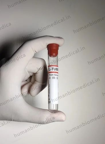 Sodium Fluoride Non Vacuum Blood Collection Tube 2