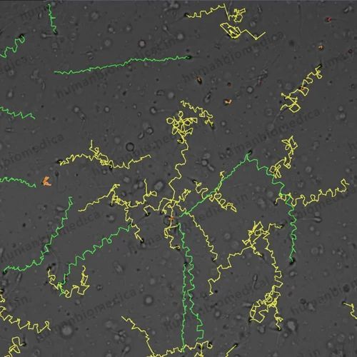 Computer Assisted Semen Analysis Software Sperm Lite