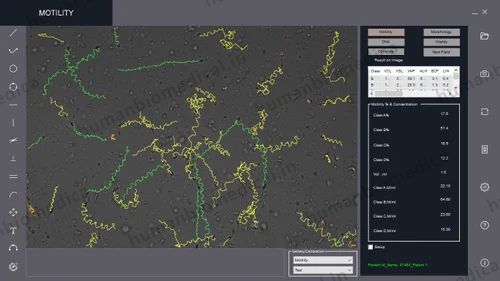 Offline CASA Software (Computer Assisted Semen Analysis) Model: SpermPro, For Windows, Free Demo/Trial Available