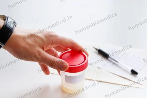 Semen Analysis