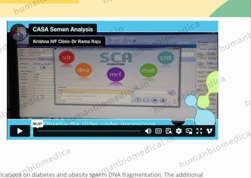 Computer Assisted Semen Analysis
