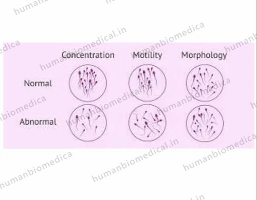 Semen Analysis Services