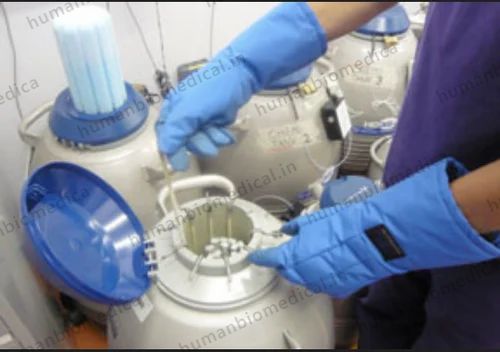 Semen Cryopreservation Treatment Service