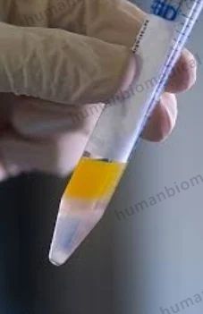 Afb Semen Test