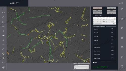 Offline CASA Software (Computer Assisted Semen Analysis) Model: SpermPro, For Windows, Free Demo/Trial Available