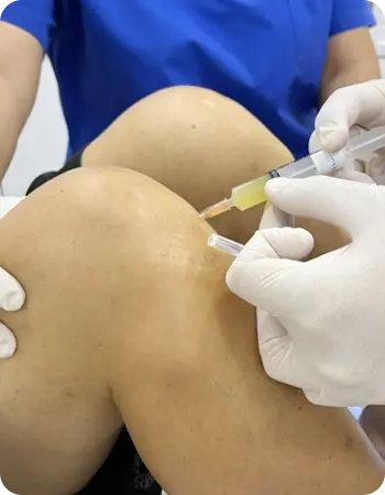 ฉีดพลาสม่าเข้าข้อเข่า