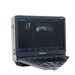 อัลตร้าซาวด์ตรวจอาการเข่าเสื่อม 4 ระยะ