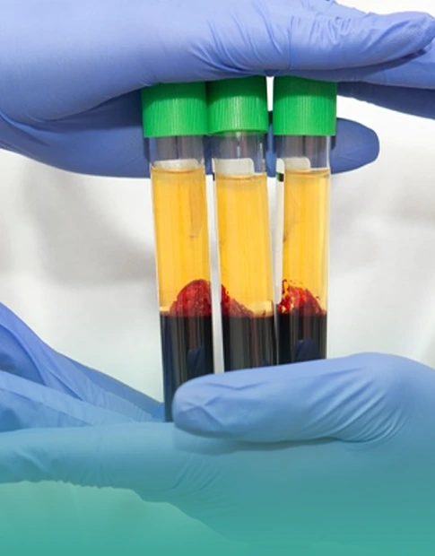 การแยก Plasma