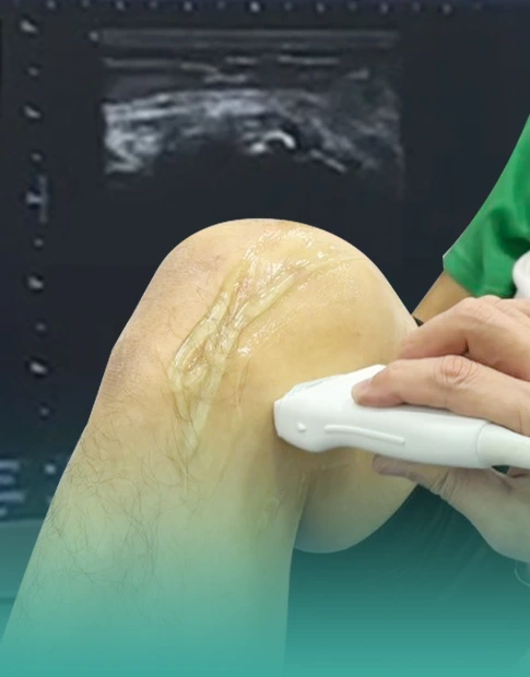 อัลตร้าซาวด์