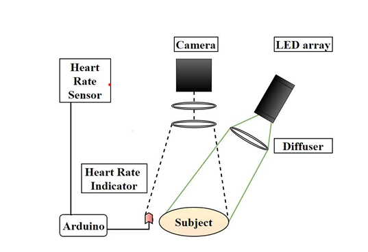 Non-Contact Vein Visualisation Device