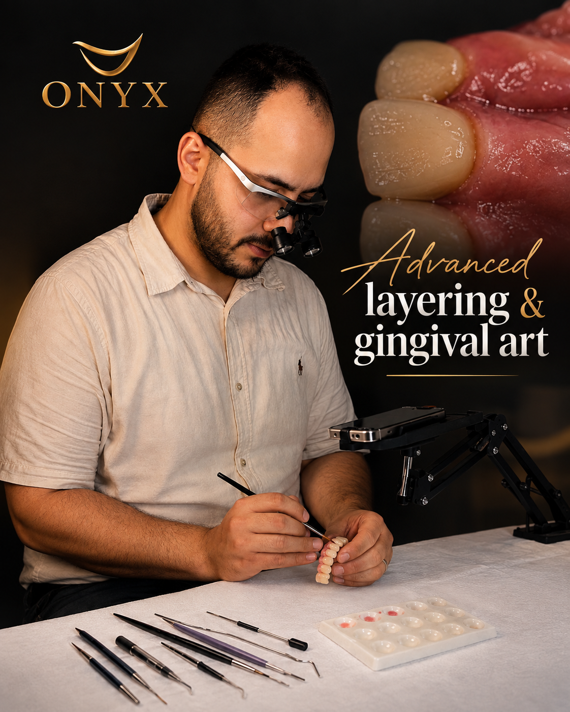 Advance layering & gingival art
