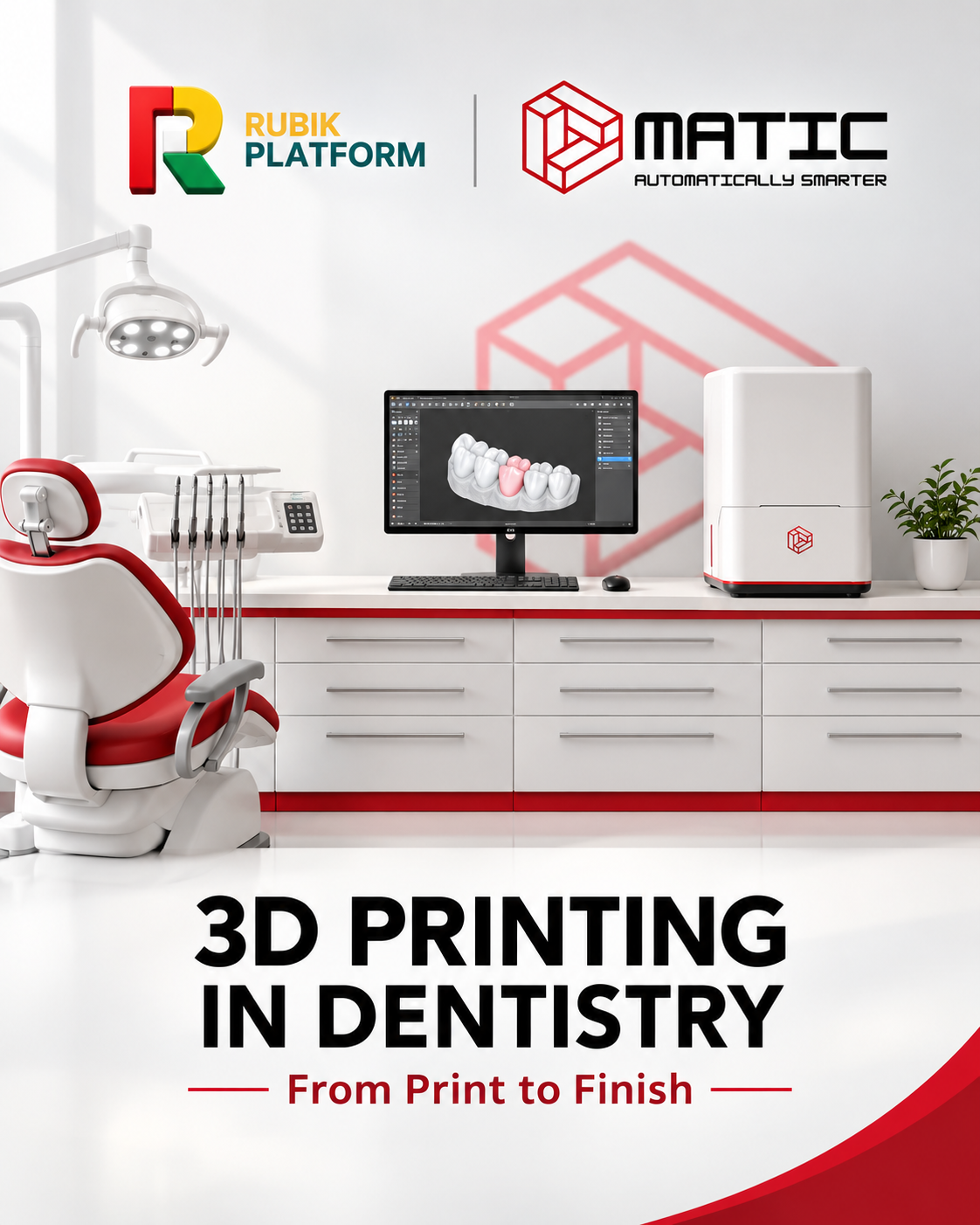 Chairside 3D Printing in Dentistry: From Scan to Cemented Restoration in a Single Visit