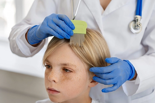 Why is so important to do head lice check?