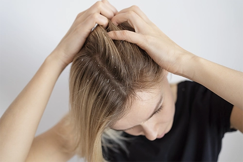 How are head lice transmitted?