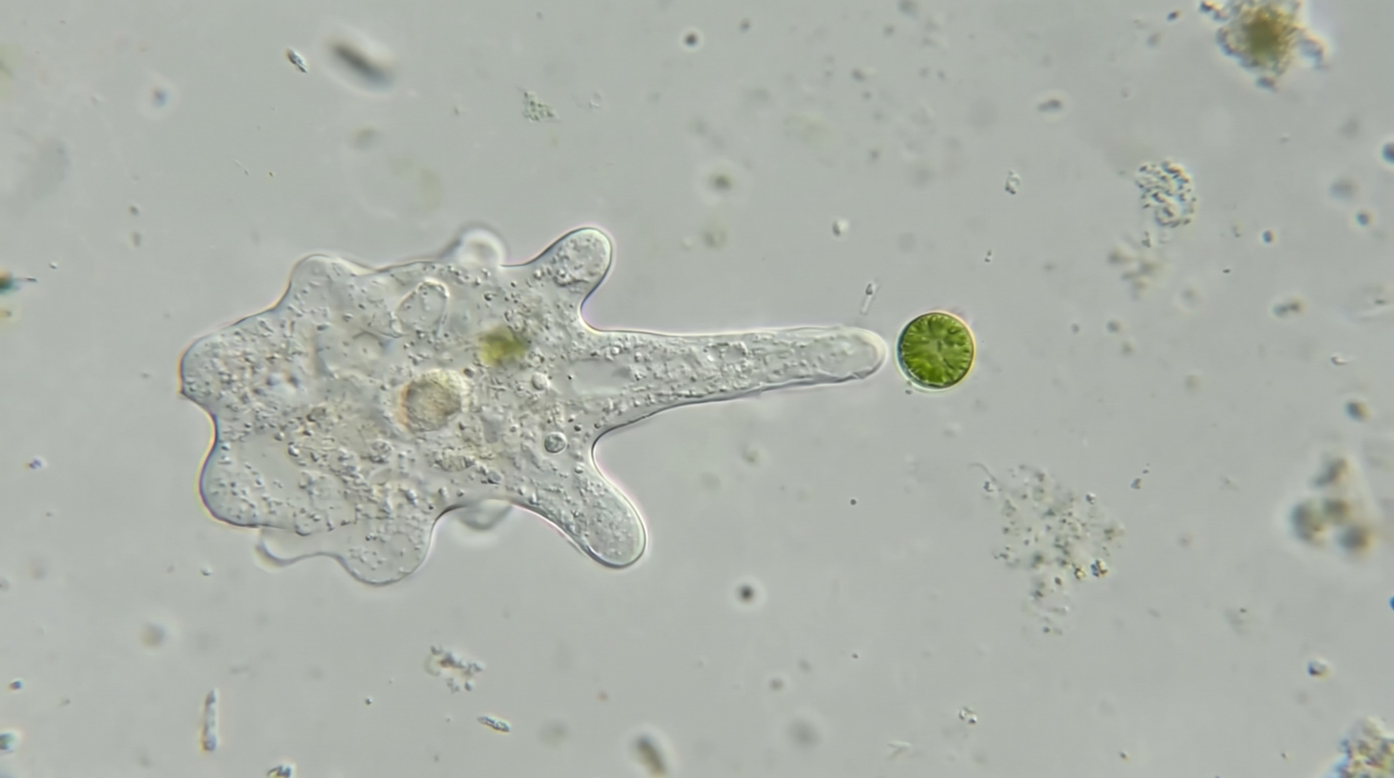 The Hidden World of Protozoans: Nature's Tiny Survivors — scene 4