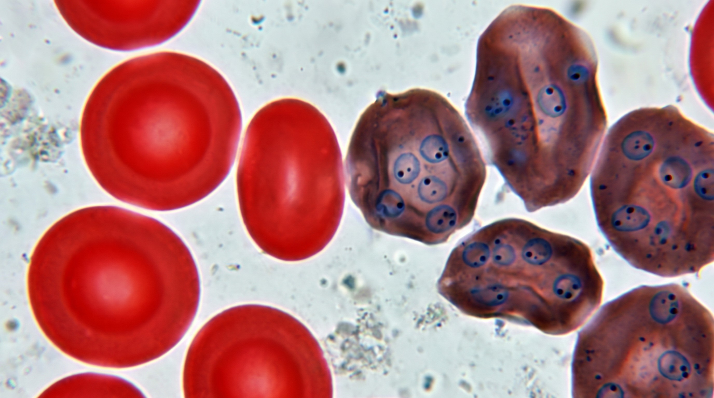 The Hidden World of Protozoans: Nature's Tiny Survivors — scene 5