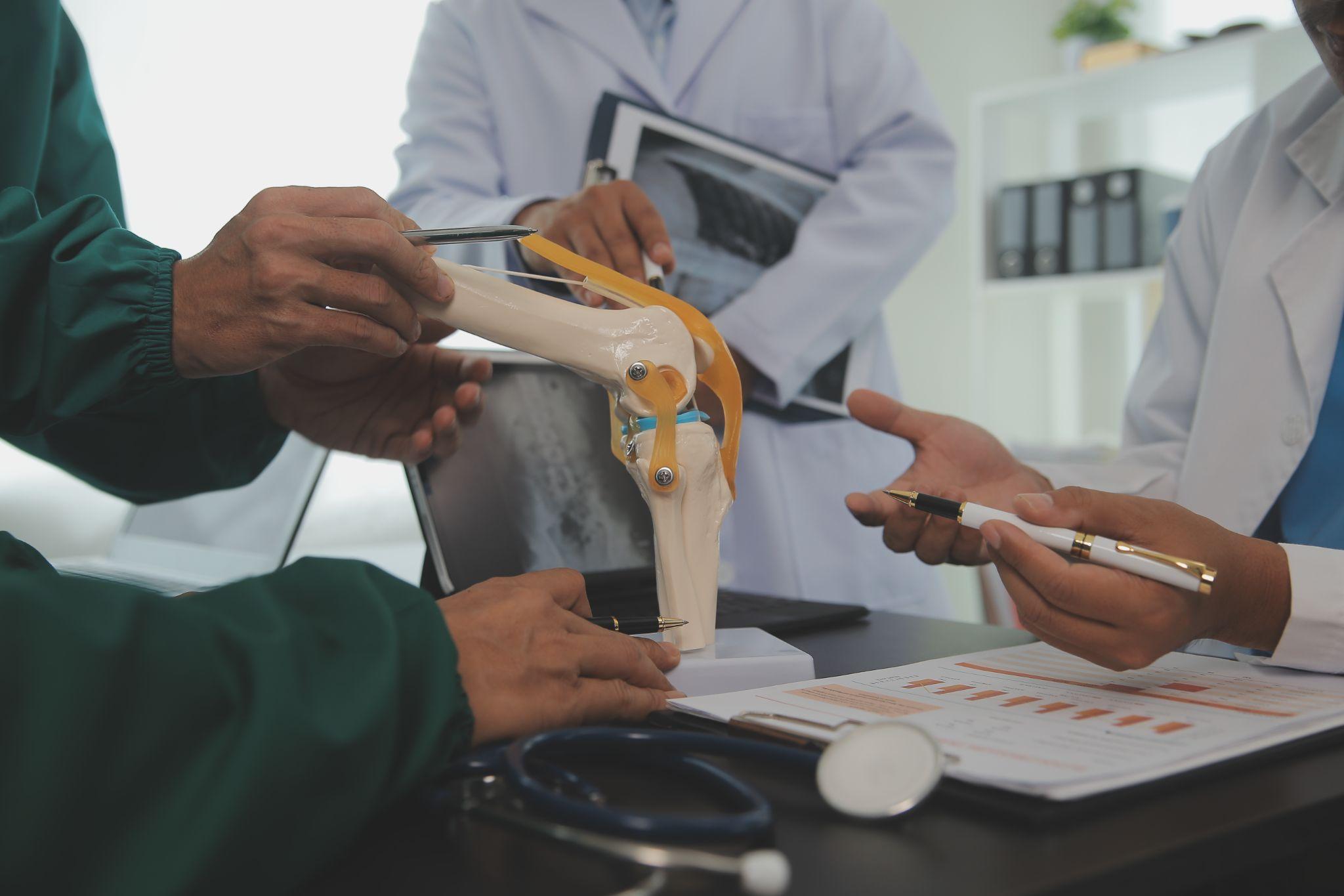Group of Doctors Discussing knee implant and injuries