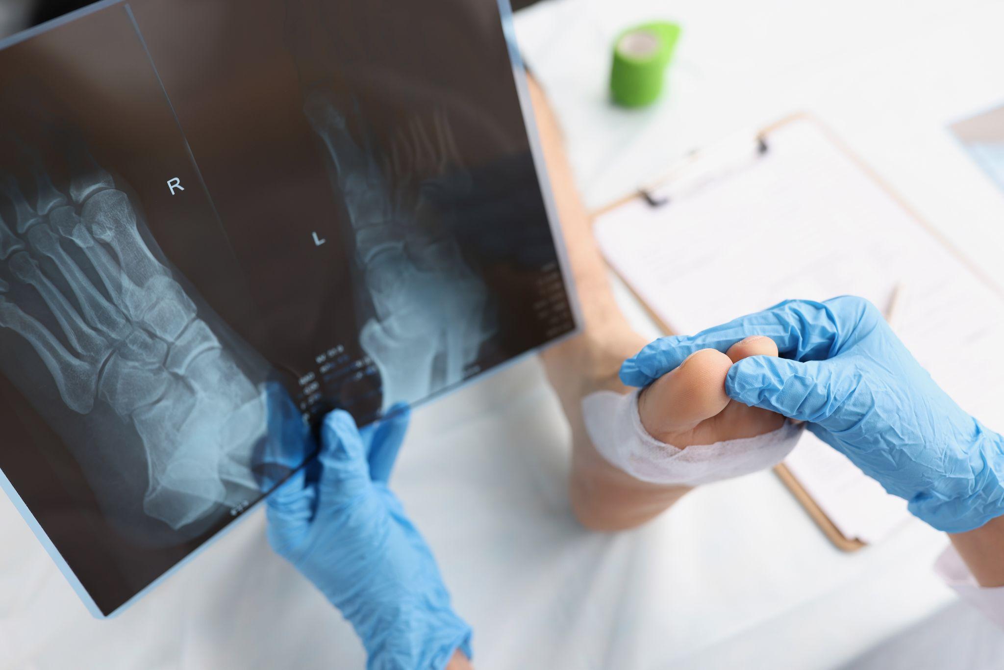 A doctor holding a Fracture X-ray