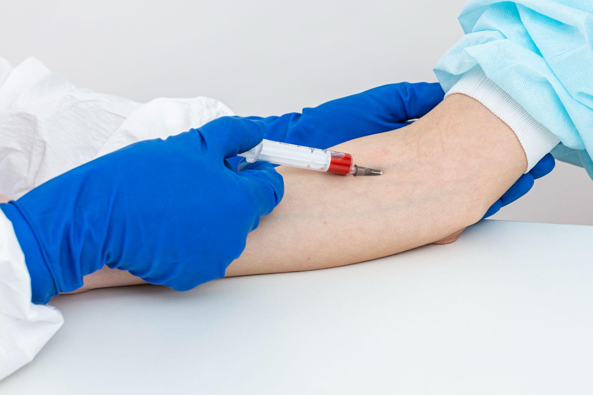 A doctor taking blood from a patient for blood checking.