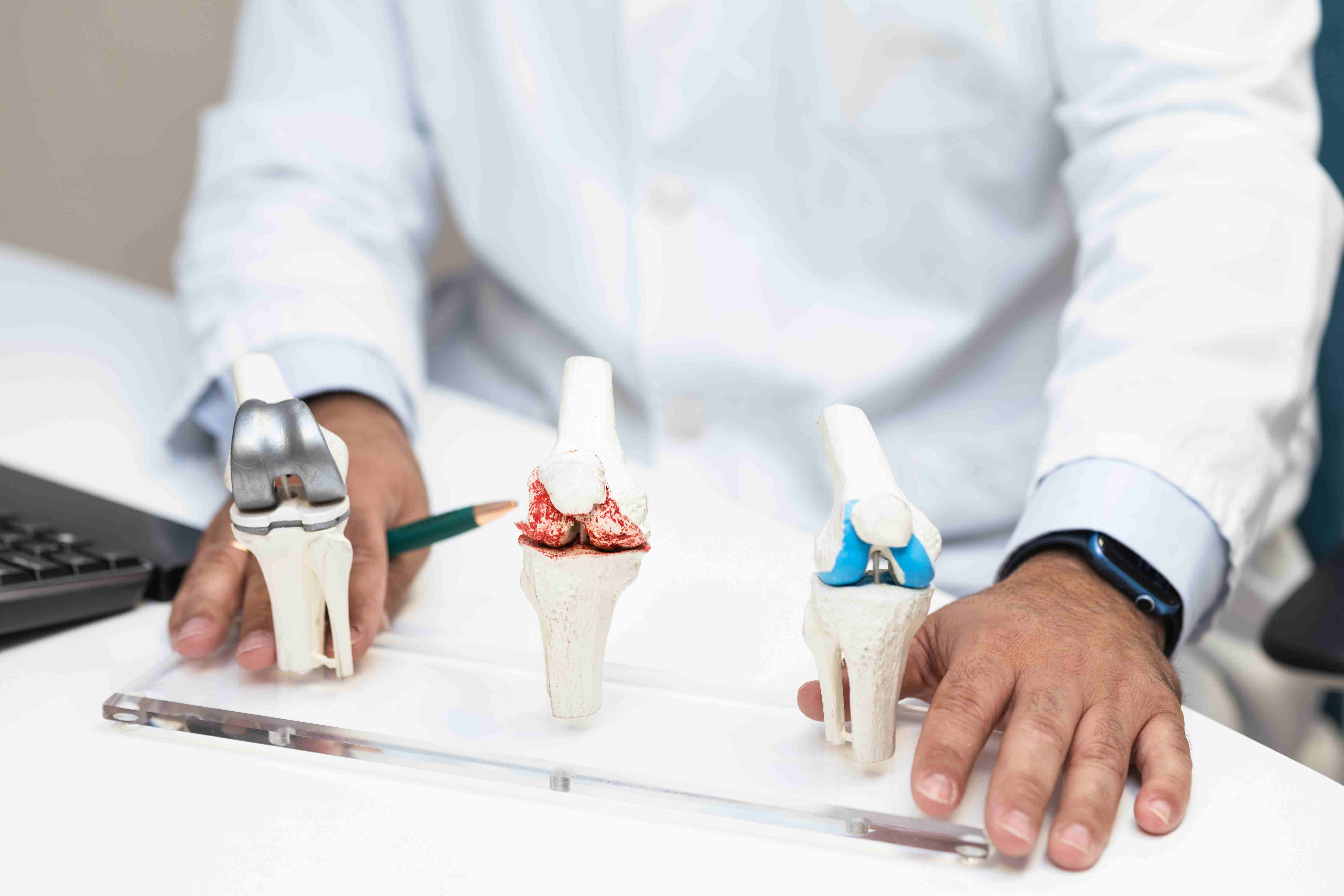Doctor explaining knee implant components and surgical choices related to partial vs total knee replacement procedures.