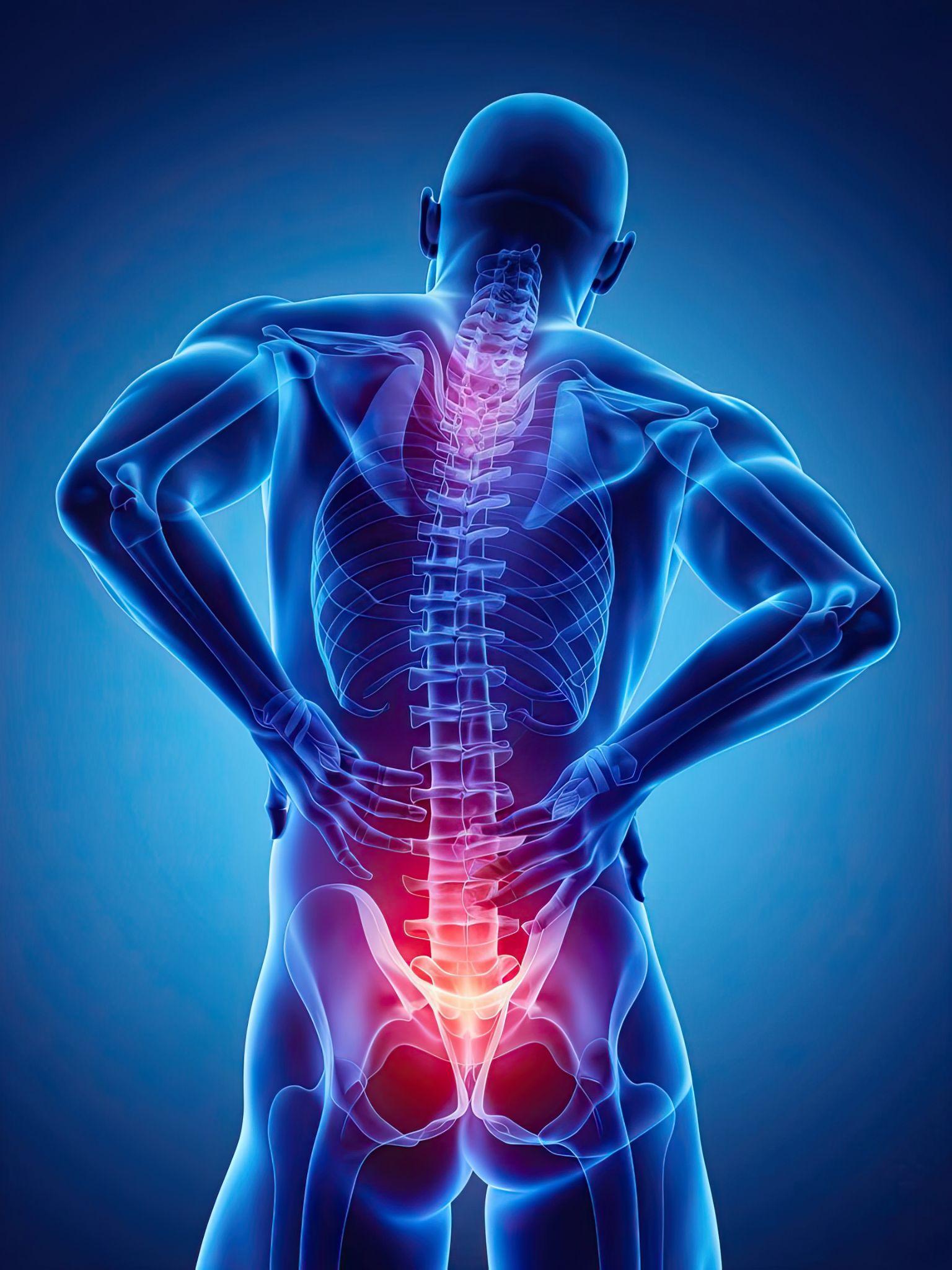 A digital 3D anatomical illustration of a human figure viewed from behind, highlighting the spine. Bright red areas along the lower spine indicate inflammation or nerve compression, commonly seen in sciatica or lumbar pain conditions.