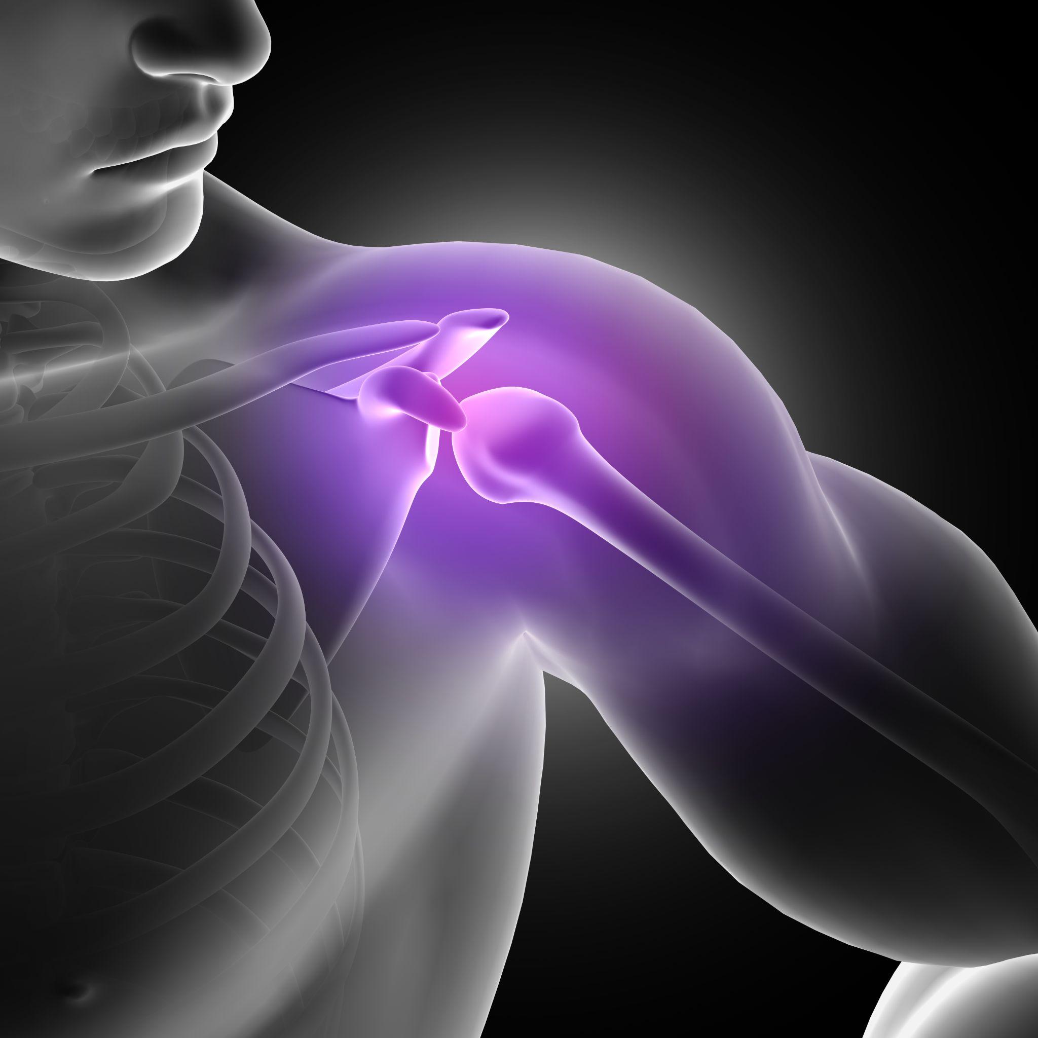 A detailed 3D illustration of the shoulder joint showing bones and joint alignment.