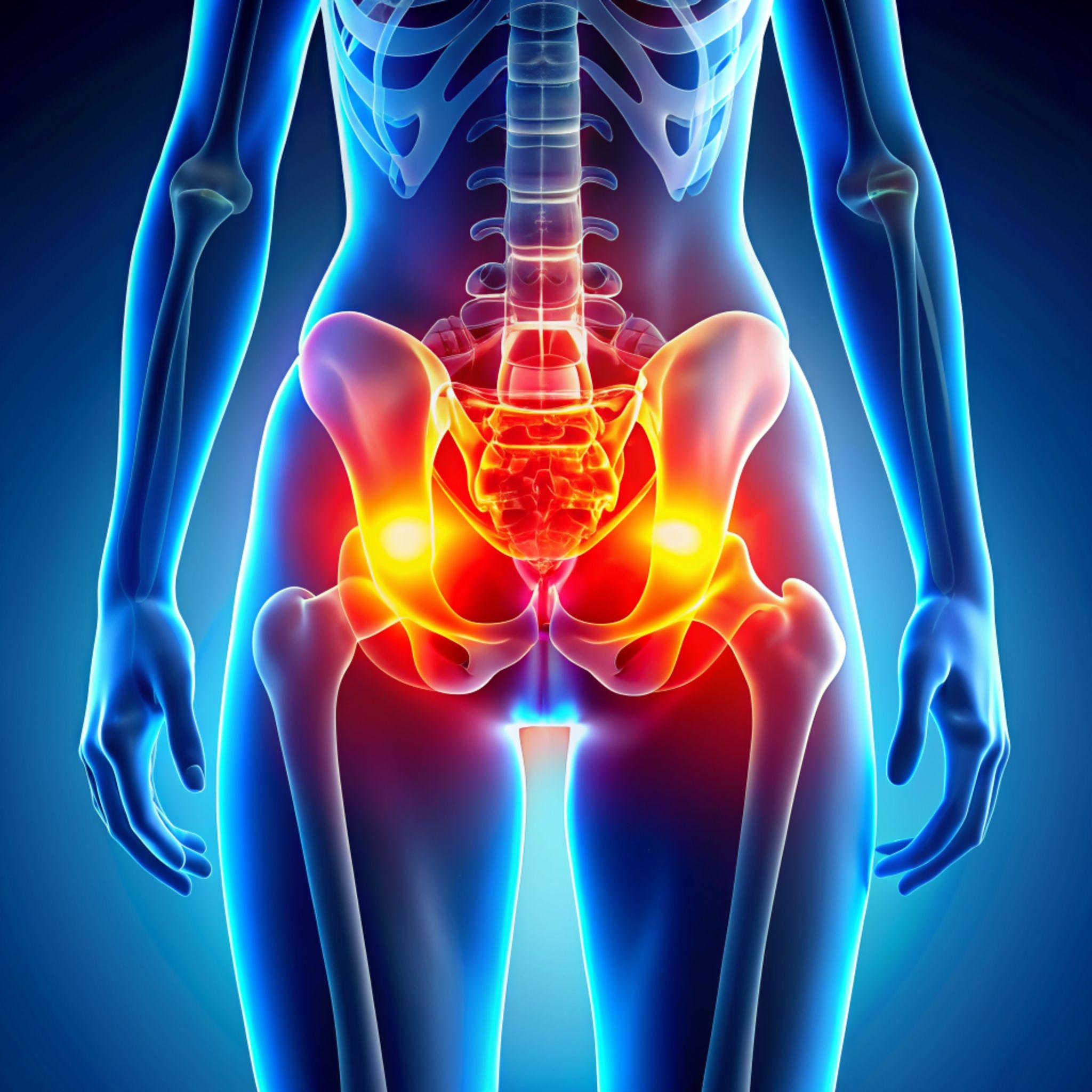 हिप रिप्लेसमेंट सर्जरी क्या है? पूरी जानकारी हिंदी में