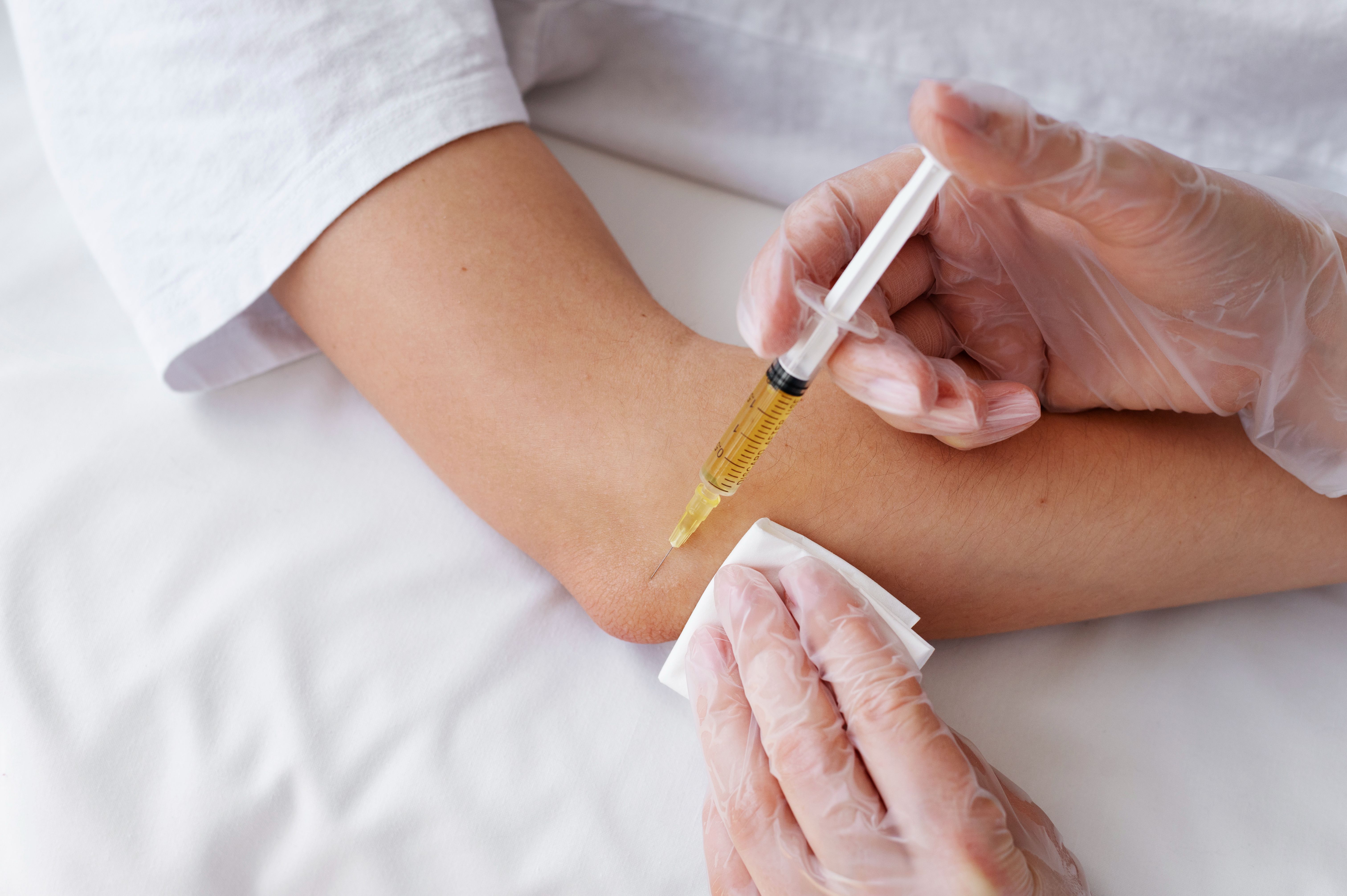 PRP Therapy for Joint Pain: What You Need to Know
