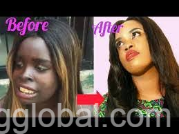 www.rentingglobal.com, renting, global, 83 Rivonia Rd, Sandhurst, Sandton, 2196, South Africa, ~+27695222391 De Number 1 Glutathione & Kojic Acid Skin Lightening Cream