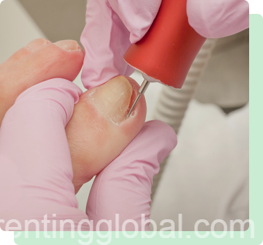 www.rentingglobal.com, renting, global, 474 Amboy Ave, Perth Amboy, NJ 08861, USA, doctor for flat feet south amboy,warts treatment new brunswick, Plantar Wart Surgeries Perth Amboy, NJ