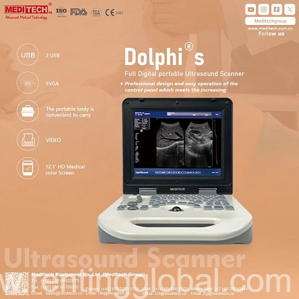  Ultrasound Scanner adopts advanced high-precision digital  beam former