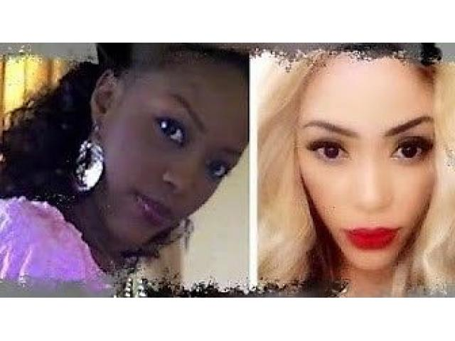 www.rentingglobal.com, renting, global, Cape Town, South Africa, scar removal cream, RESTORE YOUR SKIN USE ZAMU BEAUTY PRODUCTS +27625629073.