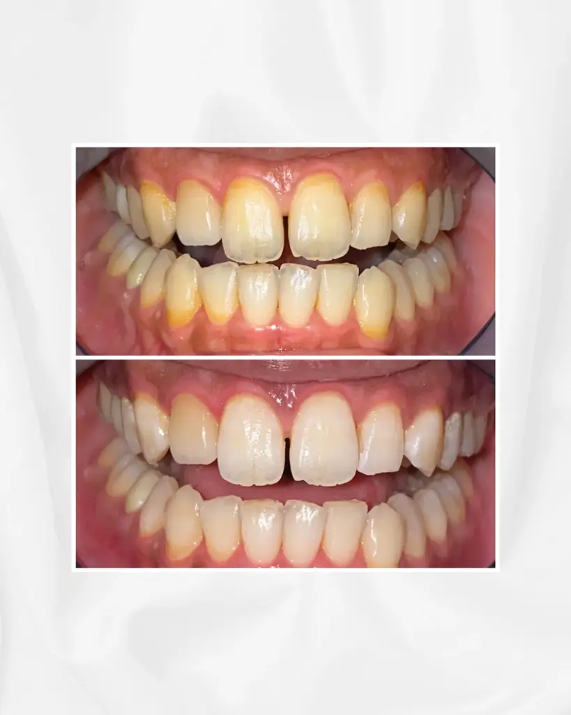 eyelash & whitening  La  Livi