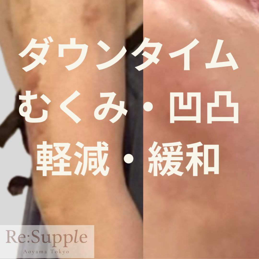 Re:Supple リサプリ|南青山　インディバ