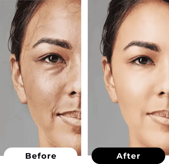 Before and after treatment results comparison