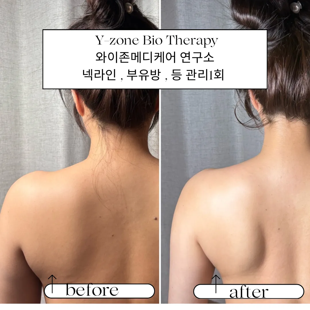 [북구] 멜로우왁싱피부광주전대점