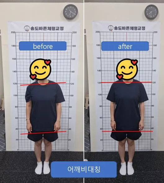 [연수구] 송도바른체형교정