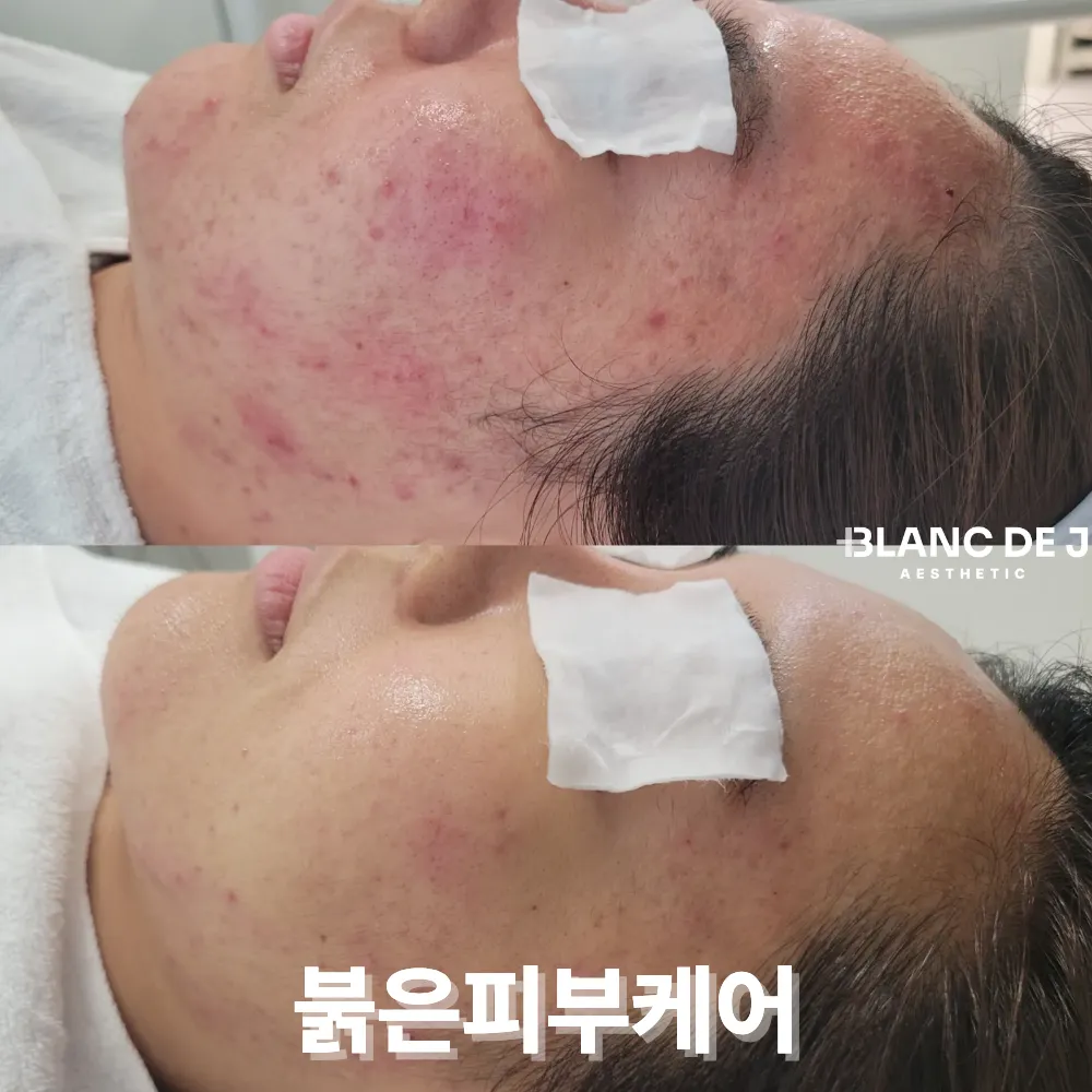 [광진구] 블랑 드 제이 에스테틱
