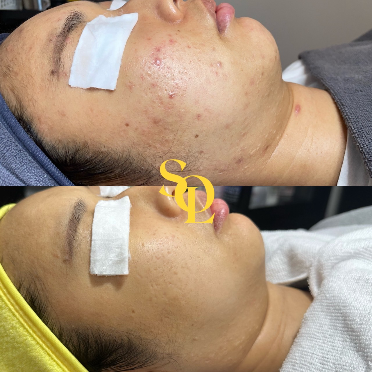 [영등포구] 솔에스테틱