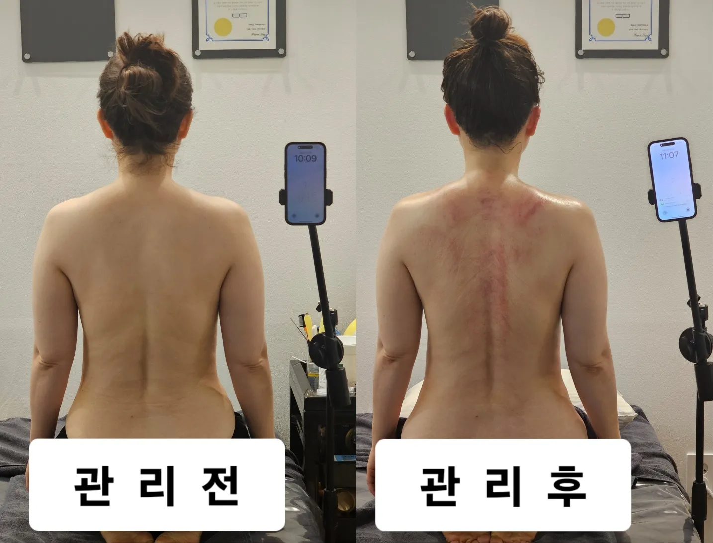 [평택시] 약손테라피