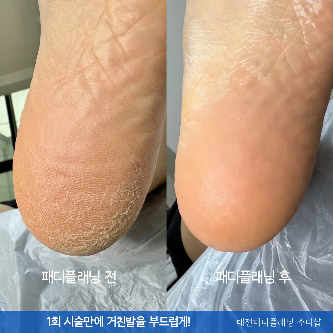 [서구] 대전주디샵 눈썹&속눈썹